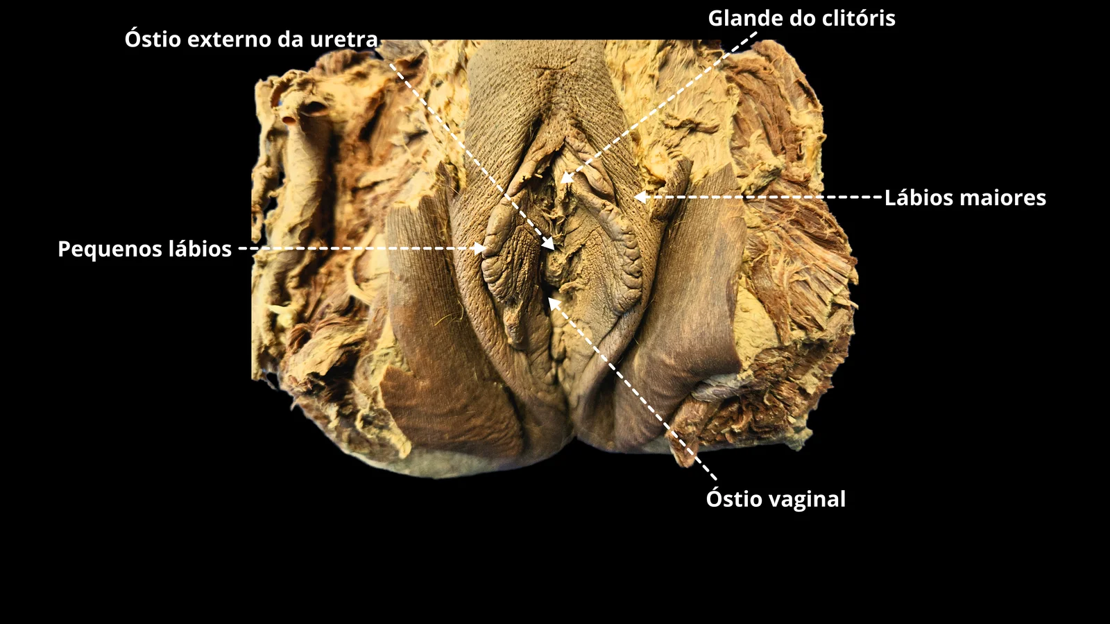 Ilustração 02 — Sistema Genital Feminino