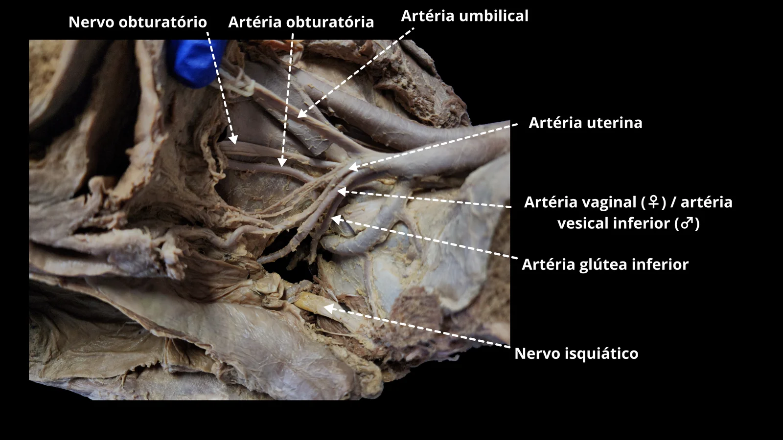 Ilustração 16 — Sistema Genital Feminino